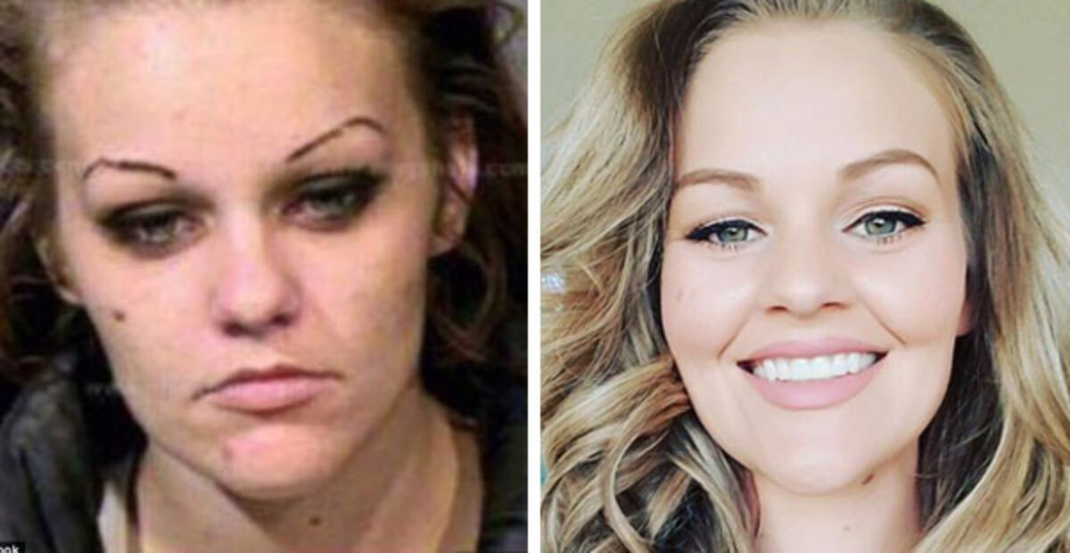 Tyttö selvisi huumehelvetistä – uskomattomat kuvat ennen ja jälkeen!