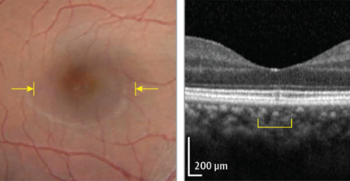 JAMA Ophthalmology