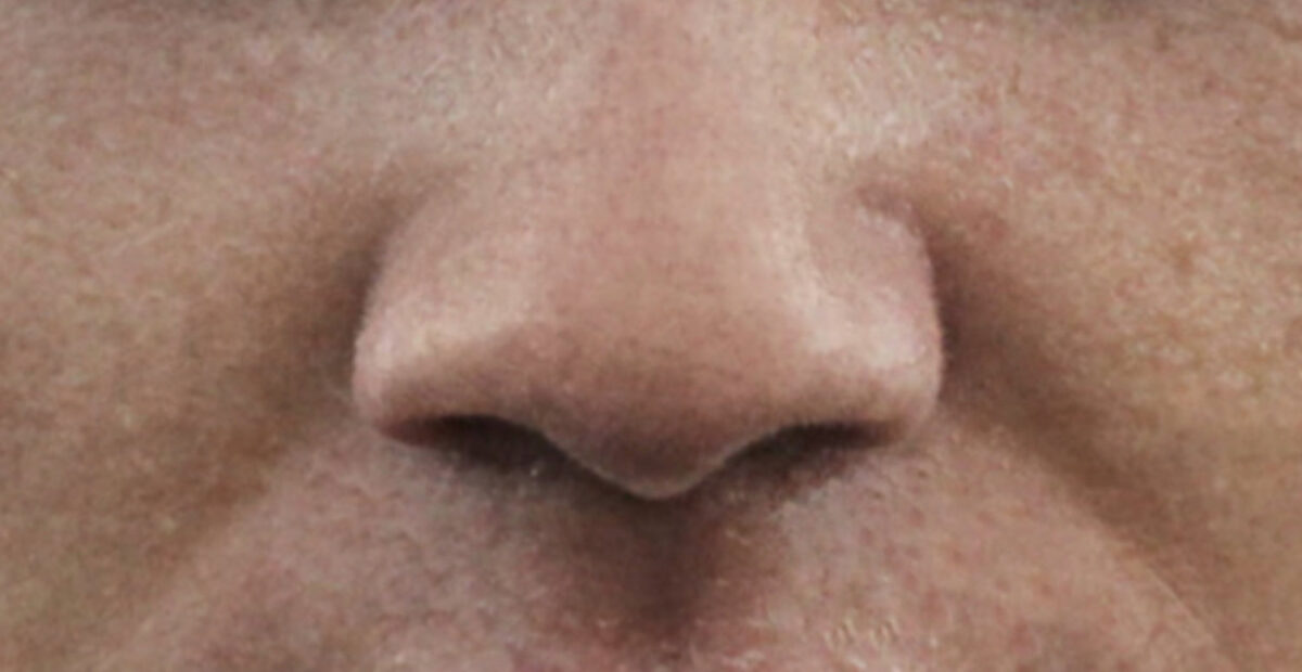 Miehen nenä lähikuvassa. Kuva: Christopher Campbell, Unsplash